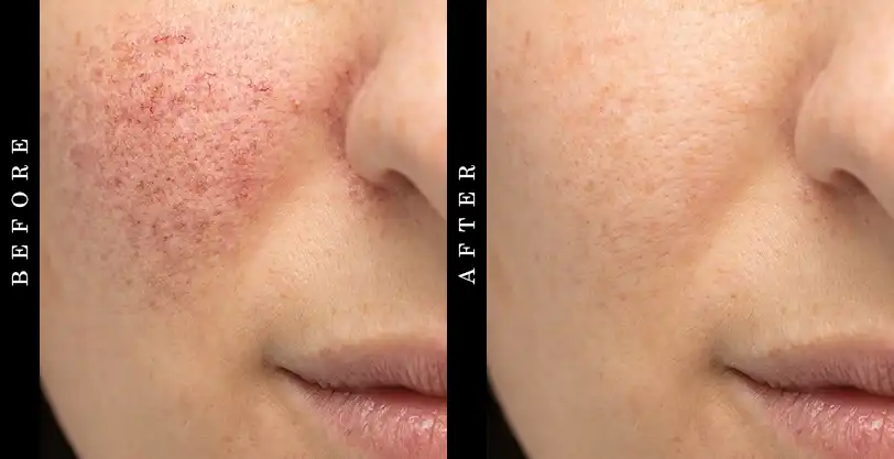 DRMTLGY Essential Cleanser Before and After